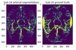 Brain artery segmentation from 4D fMRI data